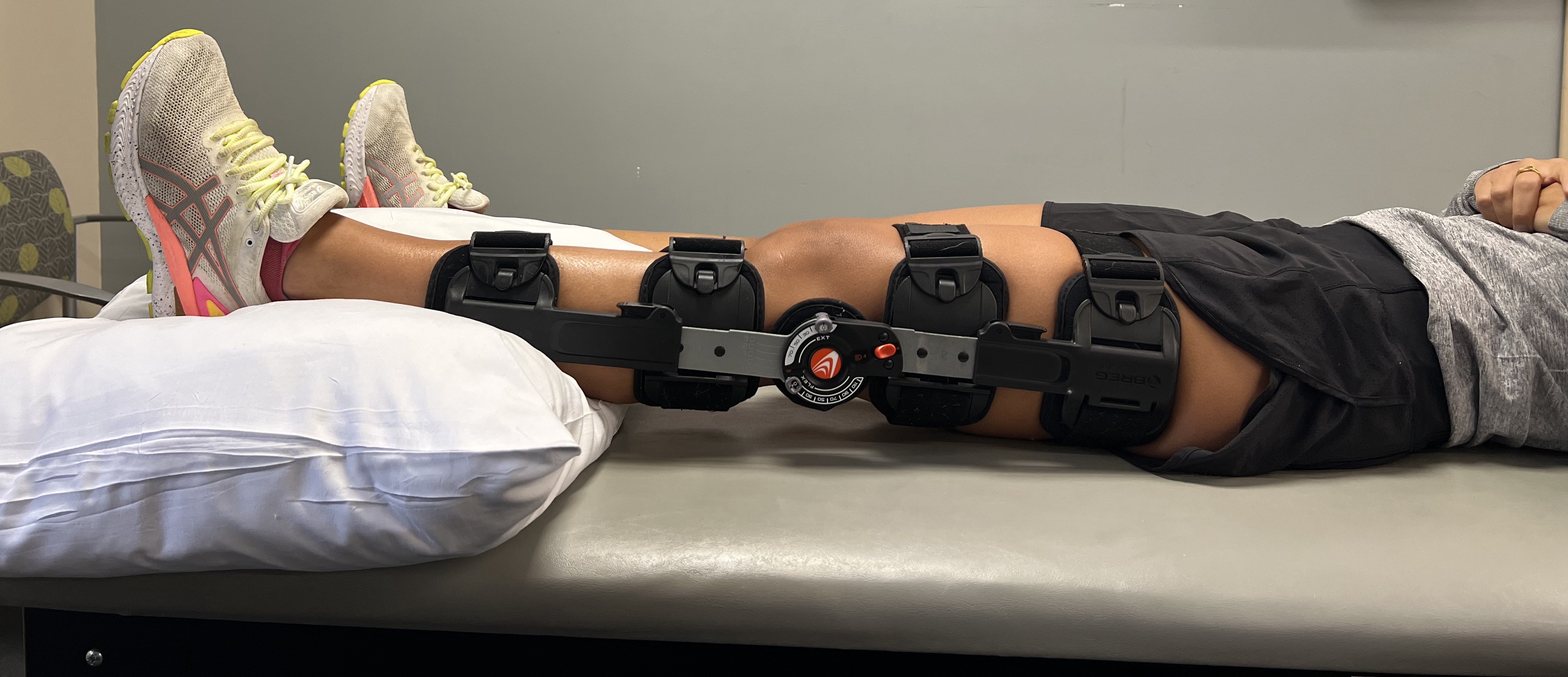 Care Immediately Following ACL Reconstruction – The Nicholas Institute of Sports Medicine and Athletic Trauma